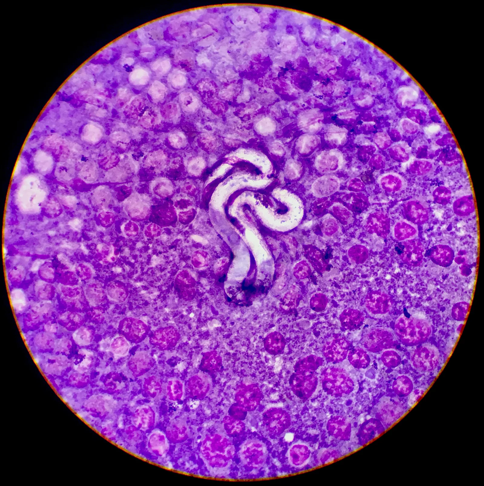 Dirofilariosis canina