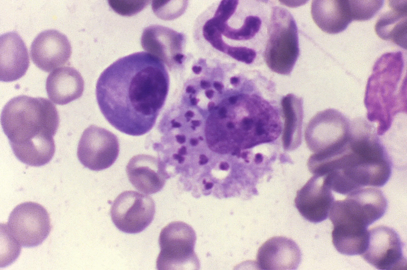 Leishmaniosis canina