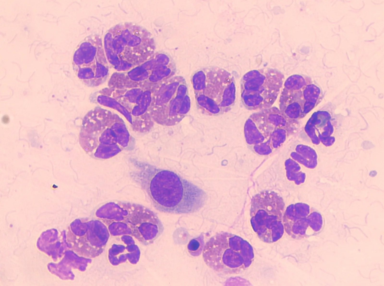 Bronconeumonía eosinofílica canina